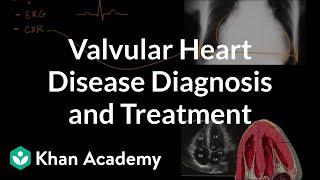 Valvular heart disease diagnosis and treatment | NCLEX-RN | Khan Academy