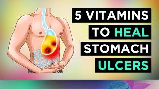 5 Vitamins That Heal STOMACH ULCERS (Naturally)