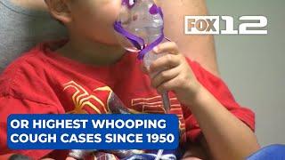 Oregon records highest whooping cough case count since 1950