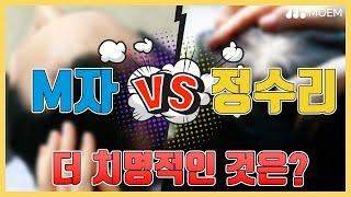 M자탈모 VS 정수리탈모 더 치명적인 것은? | 모엠의원(MOEM) | 히든컷