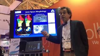 Dr. Schon on Weight-Bearing Imaging at American Academy of Orthopaedic Surgeons 2018 Annual Meeting