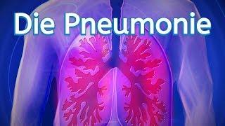 Die Pneumonie