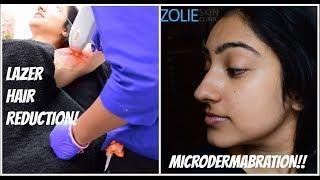 LAZER HAIR REDUCTION & MICRODERMABRATION FOR THE FIRST TIME! | ZOLIE SKIN CLINIC