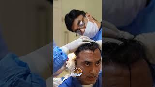 Today's procedures at Hair Club: FUE Hair Transplant with DHI technology.