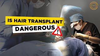 Is Hair Transplant Dangerous ? | Hair Transplant Clinic  | Dadu Medical Centre Trichology