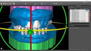 Blue Sky Bio Denture Software Beta Tutorial