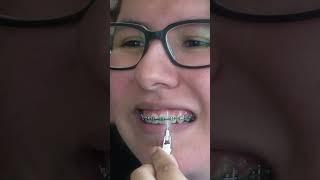 Proxabrush With Braces | English