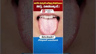 Tangedu Chettu Ayurvedic Uses in Telugu | Home Remedies Telugu | Socialpost Health #shorts