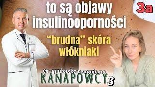 Lekarz znalazł objawy insulinooporności i niewydolności krążeniowej | Kanapowcy 3 odc. 3a