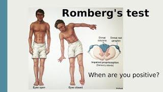 Romberg's test