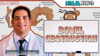 Bowel Obstruction | Clinical Medicine