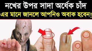 What Your Moon Sign On Nails Says About You? Uncover The Hidden Signs | নখের উপর সাদা দাগের মানে কি?