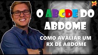 COMO AVALIAR RAIO X ABDOME ? O ABCDE DO ABDOME I VOCÊ RADIOLOGISTA