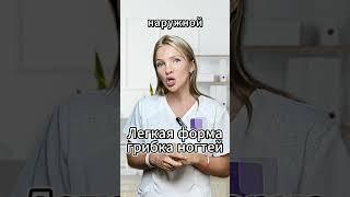 Как понять какая форма грибка ногтей у вас? #грибокногтей #грибокнаногтях