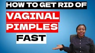 Vaginal Pimples | How to Get Rid of and Stop Vaginal Pimples Fast