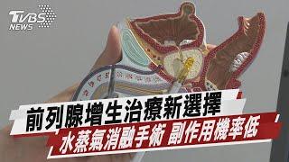 攝護腺肥大「水蒸氣消融法」手術快速風險低