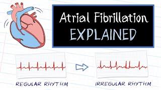 What is Atrial Fibrillation?