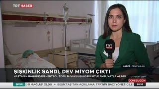 Şişkinlik sandı, dev miyom çıktı.  TRT Haber