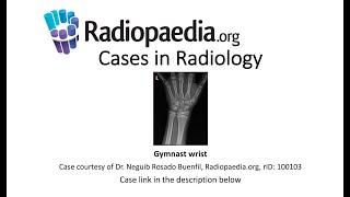 Gymnast wrist (Radiopaedia.org) Cases in Radiology