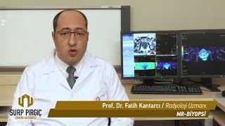 Prostat Manyetik Rezonans Ultrason Füzyon Biyopsi - Prof. Dr. Fatih Kantarcı