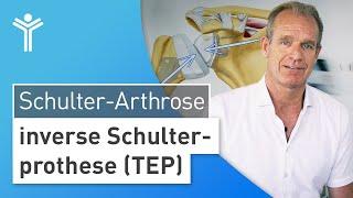 Schulterarthrose & Sehnenriss – Schulterschmerzen durch inverse Schulterprothese (TEP) behandeln