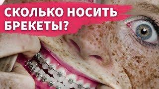 Сколько носить брекеты? Как долго нужно по времени лечиться?