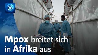 Mpox-Virus breitet sich in Afrika aus