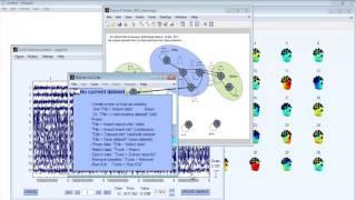 EEG Signal Processing Matlab Code Projects