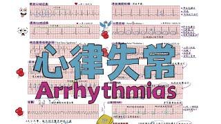 手绘精讲 | 10常见【心律失常】心电图 [Arrhythmia]  10 Common [Arrhythmia] Electrocardiogram