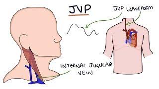 Understanding Jugular Venous Pressure (JVP)