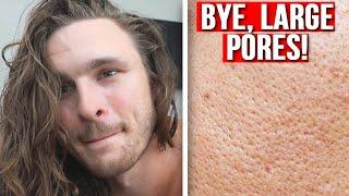 Best Ways To GET RID of Large Pores!