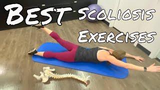 Best Scoliosis Pain Relief Exercises - Stretch & Strengthen