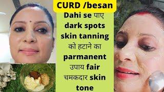 7 DAYS *TAN REMOVAL* CHALLENGE : सबसे Effective Sun Tan Removal Remedy at Home | Dark Skin Gone