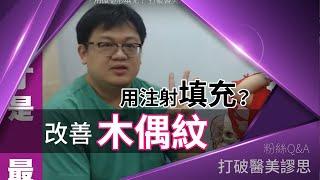 想要改善「木偶紋」，用微整形填充？ 打破醫美謬思 116-20190405