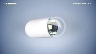 ENDOCAPSULE 10: Smart Algorithm, Safe Detection.