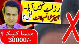 30000/- Main Hair Transplant || Hair Transplant Price in Pakistan || Best Hair Transplant clinic ||