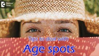 Liver spots on skin | Tips to deal with Age spots  - Dr. Rasya Dixit | Doctors' Circle