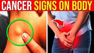 10 Early CANCER SIGNS On Your Body You Must CATCH Before It's Too Late