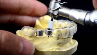 Dental implant surgical guide drilling protocol