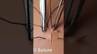 188.Figure of 8 suture #technique of suturing #dental procedure  #dentist #surgeryeducation #stitch