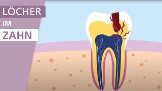 Was ist Karies? | Stiftung Gesundheitswissen