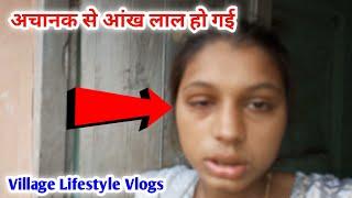 Akhon Me Conjunctivitis Hogya  | Shalu Rani Vlogs| #dailyvlogs