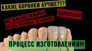 Какие коронки на зубы лучше? Металлокерамика, Цирконий, emax. Процесс работы. Изготовление коронок.