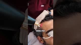 FoLix Laser Treatment | First Clinic in Washington #hairloss #hairdoctor #hairlossexpert