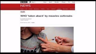 Measles and the MMR vaccine