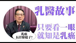 【乳醫故事54】只要看一眼，就知是乳癌!