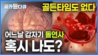 어느 날 갑자기 생긴 두통, 혹시 나도 뇌동맥류?│뇌동맥류의 전조 증상과 원인, 그리고 예방법까지│골든타임도 없는 내 머릿속의 시한폭탄!│명의│#골라듄다큐