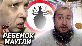 Вши пожирают ребёнка-маугли 'Пусть не говорят"