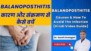 Balanoposthitis Causes & How To Avoid The Infection (Hindi Video Guide) | Dr. Sumit Sharma Urologist