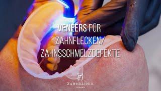 Veneers bei Zahnflecken/ Zahnschmelzdefekten [Dr. Dr. Rosanna Himmelfarb]